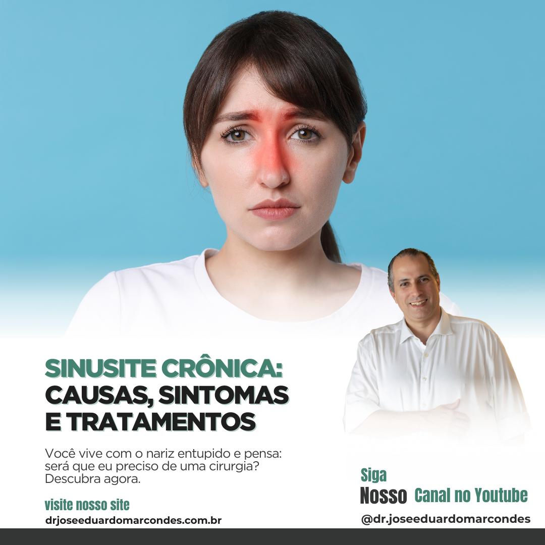 Sinusite Crônica: Causas, Sintomas e Tratamentos