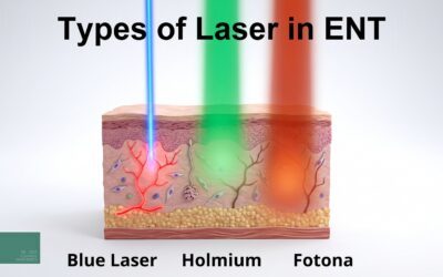 Laser in ENT: how the holmium, blue laser, and Fotona work